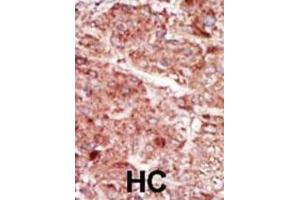 Immunohistochemistry (IHC) image for anti-Hexokinase 3 (White Cell) (HK3) antibody (ABIN3003707) (HK3 抗体)