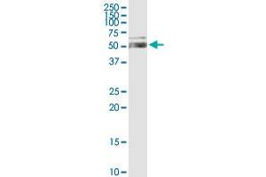 ALDH1A1 MaxPab rabbit polyclonal antibody. (ALDH1A1 抗体  (AA 1-501))