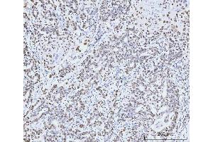 IHC analysis of MCM6 using anti-MCM6 antibody (ABIN7600037). (MCM6 抗体  (AA 14-821))