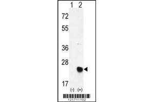 Western blot analysis of MSRB2 using rabbit polyclonal MSRB2 Antibody using 293 cell lysates (2 ug/lane) either nontransfected (Lane 1) or transiently transfected (Lane 2) with the MSRB2 gene. (MSRB2 抗体  (AA 44-73))