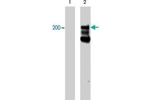 Western blot analysis of A-431 cells serum starved overnight (lane 1) and treated with pervanadate (1mM) for 30 min (lane 2). (Integrin beta 4 抗体  (pTyr1494))