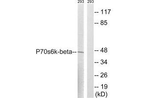 Western Blotting (WB) image for anti-Ribosomal Protein S6 Kinase, 70kDa, Polypeptide 2 (RPS6KB2) (Ser423) antibody (ABIN1848244) (RPS6KB2 抗体  (Ser423))