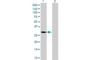 Western Blotting (WB) image for anti-Ketohexokinase (KHK) (AA 1-299) antibody (ABIN598769) (Ketohexokinase 抗体  (AA 1-299))