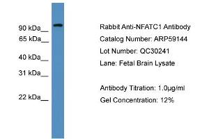 WB Suggested Anti-NFATC1  Antibody Titration: 0.