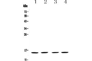 Western blot analysis of FABP5 using anti-FABP5 antibody .