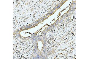 IHC analysis of HUPF2/RENT2/UPF2 using anti-HUPF2/RENT2/UPF2 antibody (ABIN7600567). (RENT2/UPF2 抗体  (AA 200-651))