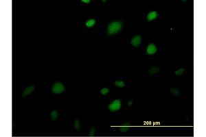 Immunofluorescence of monoclonal antibody to MAZ on HeLa cell. (MAZ 抗体  (AA 332-440))