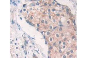 Used in DAB staining on fromalin fixed paraffin- embedded Kidney tissue (SRPK3 抗体  (AA 247-517))