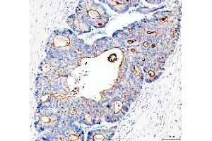 IHC analysis of MUC13 using anti-MUC13 antibody (ABIN6719597). (MUC13 抗体  (AA 226-312))