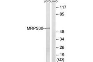 Western blot analysis of extracts from LOVO cells, using MRPS30 Antibody. (MRPS30 抗体  (AA 390-439))
