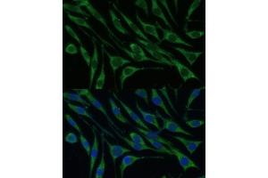 Immunofluorescence analysis of L929 cells using VARS Polyclonal Antibody (ABIN1683239, ABIN3018665, ABIN3018666 and ABIN6220533) at dilution of 1:100 (40x lens). (VARS 抗体  (AA 1-280))