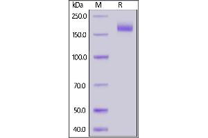 SDS-PAGE (SDS) image for SARS-CoV-2 Spike (Super Stable Trimer) protein (His tag) (ABIN6953299)