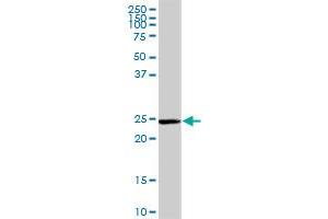 GSTM5 MaxPab rabbit polyclonal antibody. (GSTM5 抗体  (AA 1-218))