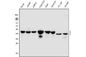 Western blot analysis of Cbx8 using anti-Cbx8 antibody (ABIN7599341).