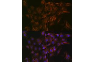 Immunofluorescence analysis of C6 cells using Arp3 Rabbit mAb (ABIN7265676) at dilution of 1:100 (40x lens). (ACTR3 抗体)