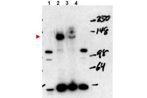 Image no. 1 for anti-Nuclear Receptor Coactivator 3 (NCOA3) (Internal Region), (Isoform A) antibody (ABIN401408) (NCOA3 抗体  (Internal Region, Isoform A))