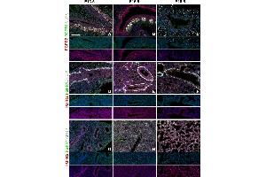 Immunostaining for ADR (ABIN285650) see (D–I): Immunostaining on E13. (ADRP 抗体  (N-Term))