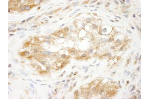 Immunohistochemistry (IHC) image for anti-Tripartite Motif Containing 3 (TRIM3) (AA 1-50) antibody (ABIN7448842) (TRIM3 抗体  (AA 1-50))