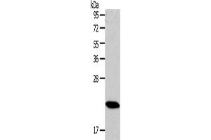 Western Blotting (WB) image for anti-RAB18, Member RAS Oncogene Family (RAB18) antibody (ABIN2430977) (RAB18 抗体)