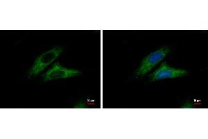ICC/IF Image Alpha-catulin antibody [N3C2], Internal detects Alpha-catulin protein at cytoplasm by immunofluorescent analysis. (CTNNAL1 抗体  (Internal Region))