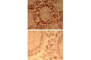 Immunohistochemical analysis of human colon tissue using TLR7 polyclonal antibody  (top) and an isotype control (bottom) at 5 ug/mL . (TLR7 抗体  (AA 706-728))