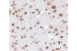 Immunohistochemistry of FTO in mouse brain tissue with FTO antibody at 2. (FTO 抗体  (N-Term))