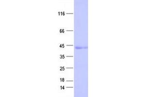 Validation with Western Blot