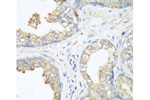 Immunohistochemistry of paraffin-embedded Human prostate using CBL Polyclonal Antibody at dilution of 1:200 (40x lens). (CBL 抗体)