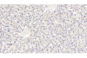 Immunohistochemistry (IHC) image for anti-Lipolysis Stimulated Lipoprotein Receptor (LSR) (AA 335-589) antibody (ABIN7426916)
