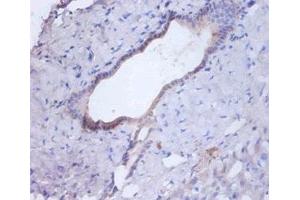 Immunohistochemistry of paraffin-embedded human liver tissue using ABIN7146996 at dilution of 1:100 (Cathepsin B 抗体  (AA 82-333))