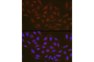 Immunofluorescence analysis of U2OS cells using  Rabbit pAb (ABIN6131258, ABIN6137246, ABIN6137247 and ABIN6223428) at dilution of 1:100 (40x lens).