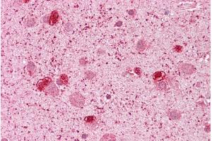 Immunohistochemistry with Brain, cortex tissue at an antibody concentration of 5µg/ml using anti-GSH2 antibody (ARP32208_P050) (GSX2 抗体  (N-Term))