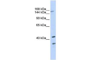 Western Blotting (WB) image for anti-ATP-Binding Cassette, Sub-Family C (CFTR/MRP), Member 8 (ABCC8) (N-Term) antibody (ABIN2781496)
