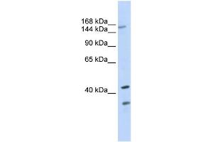 WB Suggested Anti-ABCC8 Antibody Titration:  0. (ABCC8 抗体  (N-Term))
