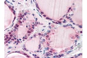 Image no. 1 for anti-F-Box and Leucine-Rich Repeat Protein 3 (FBXL3) (N-Term) antibody (ABIN372963) (FBXL3 抗体  (N-Term))