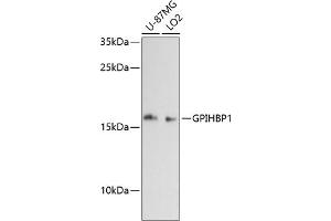 Western blot analysis of extracts of various cell lines, using GPIHBP1 antibody (ABIN6131315, ABIN6141330, ABIN6141331 and ABIN6217167) at 1:3000 dilution. (GPIHBP1 抗体  (AA 50-151))