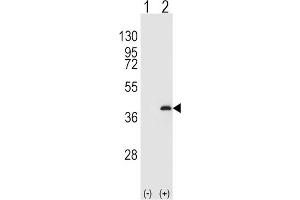 Western Blotting (WB) image for anti-Protein Phosphatase 1, Catalytic Subunit, beta Isoform (PPP1CB) antibody (ABIN3003759) (PPP1CB 抗体)