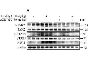 Injection of JAK2/STAT5 inhibitor abolished the promotive effect of Pro-Gly on IGF-1 expression and secretion in mice.