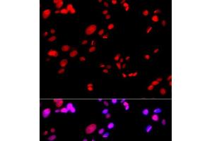 Immunofluorescence analysis of GFP-RNF168 transgenic U2OS cells using RPA2 Polyclonal Antibody (RPA2 抗体)