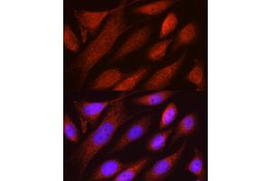 Immunofluorescence analysis of U2OS cells using RHOT2 Rabbit pAb (ABIN3016307, ABIN3016308, ABIN1682532 and ABIN6219710) at dilution of 1:50 (40x lens). (RHOT2 抗体  (AA 280-480))