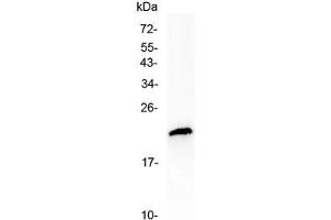 Western blot testing of human MCF7 cell lysate with TMEM107 antibody at 0. (TMEM107 抗体  (AA 22-57))