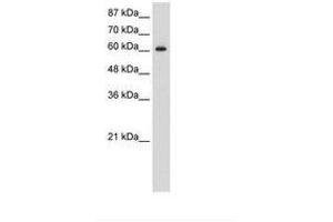 Image no. 2 for anti-Hypoxia Inducible Factor 3, alpha Subunit (HIF3A) (C-Term) antibody (ABIN203237) (HIF3A 抗体  (C-Term))