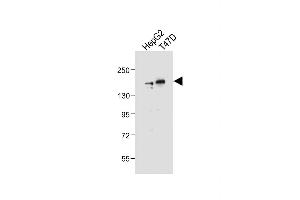 All lanes : Anti-HDAC6 Antibody (C-term) at 1:2000 dilution Lane 1: HepG2 whole cell lysate Lane 2: T47D whole cell lysate Lysates/proteins at 20 μg per lane. (HDAC6 抗体  (C-Term))