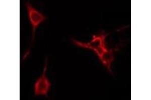 ABIN6274980 staining Hela cells by IF/ICC.