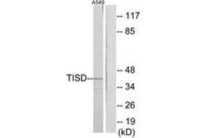 Western blot analysis of extracts from A549 cells, using TISD Antibody. (TISD 抗体  (AA 207-256))