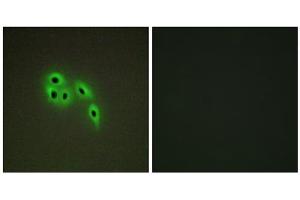 Immunofluorescence analysis of A549 cells, using DOK6 antibody. (DOK6 抗体  (Internal Region))