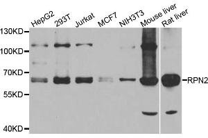Western blot analysis of extracts of various cell lines, using RPN2 antibody (ABIN5974836) at 1/1000 dilution. (Ribophorin II 抗体)