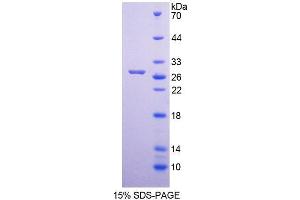 SDS-PAGE analysis of Human MUTYH Protein. (MUTYH 蛋白)