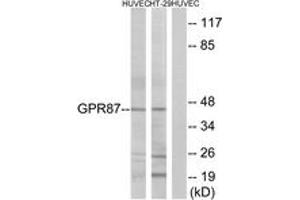 Western blot analysis of extracts from HuvEc/HT-29 cells, using GPR87 Antibody. (GPR87 抗体  (AA 221-270))