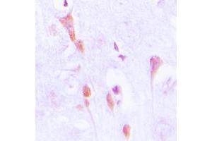 Immunohistochemical analysis of Beta-arrestin-1 (pS412) staining in human brain formalin fixed paraffin embedded tissue section. (beta Arrestin 1 抗体  (C-Term, pSer412))